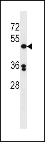 Rabbit Polyclonal Antibody to POLD3