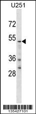 Rabbit Polyclonal Antibody to YTHD2