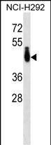 Rabbit Polyclonal Antibody to PABPC4L