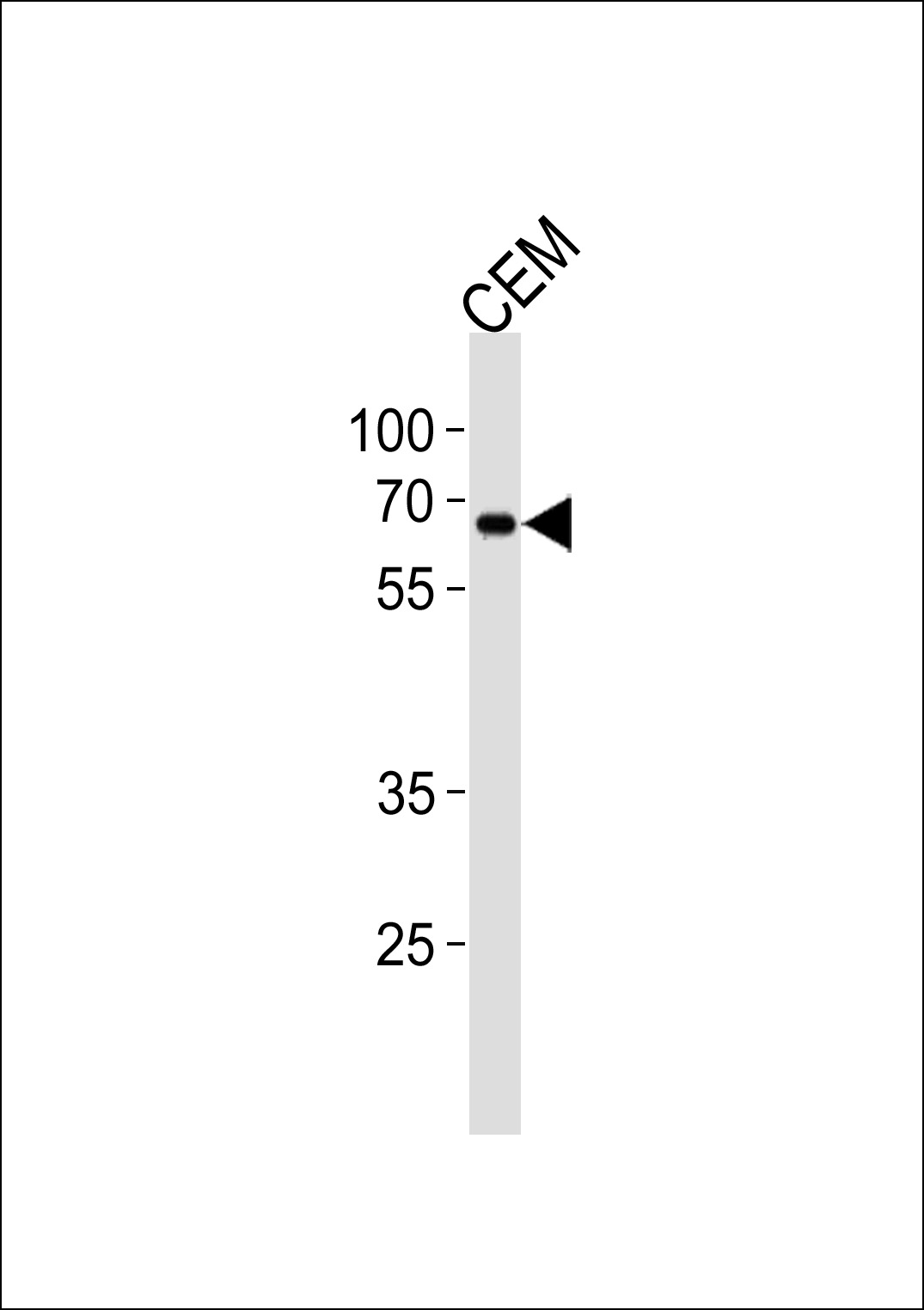 Rabbit Polyclonal Antibody to ZNF90