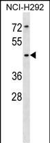 Rabbit Polyclonal Antibody to SIGLEC14 (N-term)