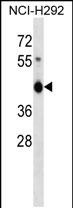 Rabbit Polyclonal Antibody to ZNF843