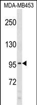 Rabbit Polyclonal Antibody to COL6A2