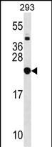 Rabbit Polyclonal Antibody to RPL9