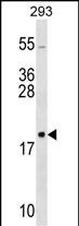 Rabbit Polyclonal Antibody to RPL26