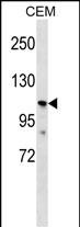 Rabbit Polyclonal Antibody to PKD2L1 (N-term)