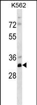 Rabbit Polyclonal Antibody to PRPS2