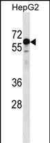 Rabbit Polyclonal Antibody to KLHL25 (N-term)