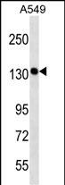 Rabbit Polyclonal Antibody to PDS5A