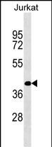 Rabbit Polyclonal Antibody to RBMS2 (N-term)