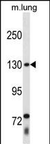Rabbit Polyclonal Antibody to THRAP3