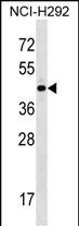 Rabbit Polyclonal Antibody to ZNF436 (N-term)