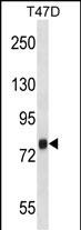 Rabbit Polyclonal Antibody to ZC3H14