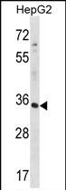 Rabbit Polyclonal Antibody to RFNG