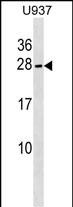 Rabbit Polyclonal Antibody to NKIRAS2