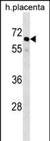 Rabbit Polyclonal Antibody to GRHL3 (N-term)