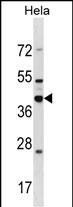 Rabbit Polyclonal Antibody to DND1
