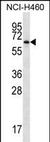 Rabbit Polyclonal Antibody to ZBTB46