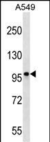 Rabbit Polyclonal Antibody to CCDC141 (N-term)