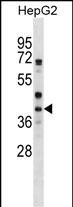 Rabbit Polyclonal Antibody to WNT6