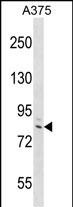 Rabbit Polyclonal Antibody to DEF6