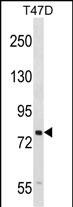 Rabbit Polyclonal Antibody to SEL1L (N-term)