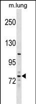 Rabbit Polyclonal Antibody to MPP5