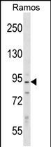 Rabbit Polyclonal Antibody to PPP1R9B (N-term)