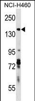 Rabbit Polyclonal Antibody to DIAPH3