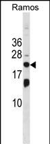Rabbit Polyclonal Antibody to ISG20
