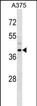 Rabbit Polyclonal Antibody to SNUPN