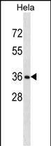 Rabbit Polyclonal Antibody to RNF34