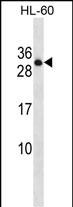 Rabbit Polyclonal Antibody to PTPRCAP