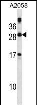 Rabbit Polyclonal Antibody to PLA2G12A