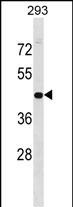 Rabbit Polyclonal Antibody to GPN1
