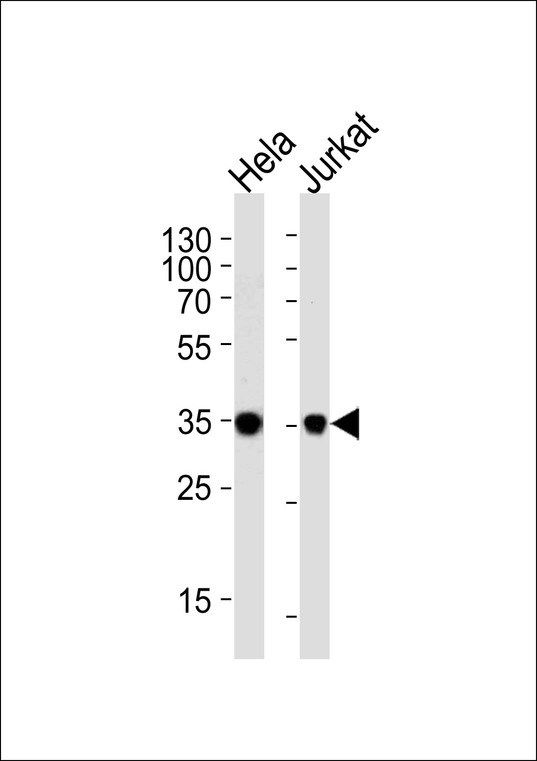 Rabbit Polyclonal Antibody to FRG1
