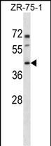 Rabbit Polyclonal Antibody to PANX3 (N-term)