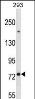 Rabbit Polyclonal Antibody to MED16