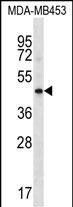 Rabbit Polyclonal Antibody to HAPLN3