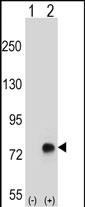 Rabbit Polyclonal Antibody to TGFBI (N-term)