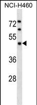 Rabbit Polyclonal Antibody to KPTN
