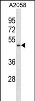 Rabbit Polyclonal Antibody to BFAR (N-term)