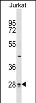 Rabbit Polyclonal Antibody to CTDSP1 (N-term)
