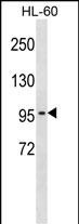Rabbit Polyclonal Antibody to CLCN2 (N-term)