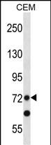 Rabbit Polyclonal Antibody to PRDM8 (N-term)