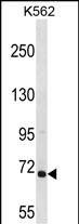 Rabbit Polyclonal Antibody to ARHGEF6
