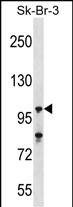 Rabbit Polyclonal Antibody to USP16 (N-term)