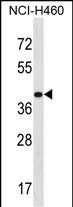 Rabbit Polyclonal Antibody to MRPS9