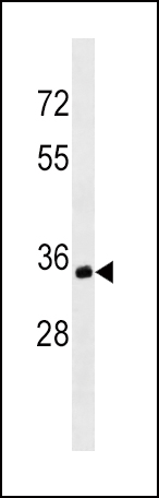 Mouse Monoclonal Antibody to MS4A1/CD20