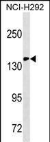 Mouse Monoclonal Antibody to ITGAX/CD11c (N-term)(Ascites)
